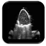 Quantitative PIV Enabled Echocardiography Techniques